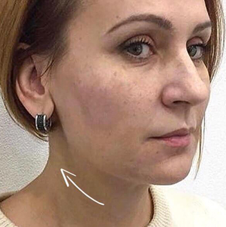 Жінка після